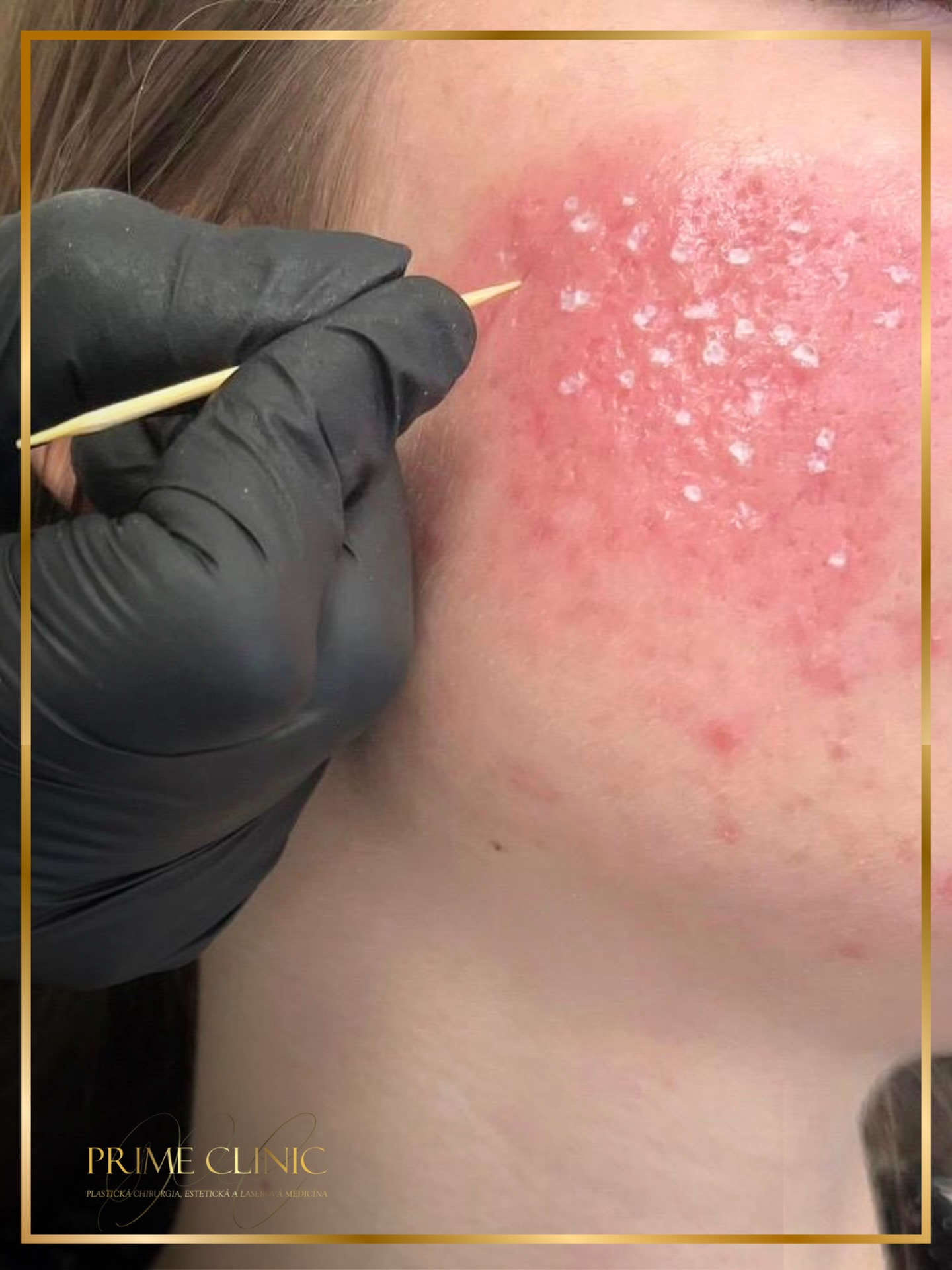 Prime Clinic treatment result