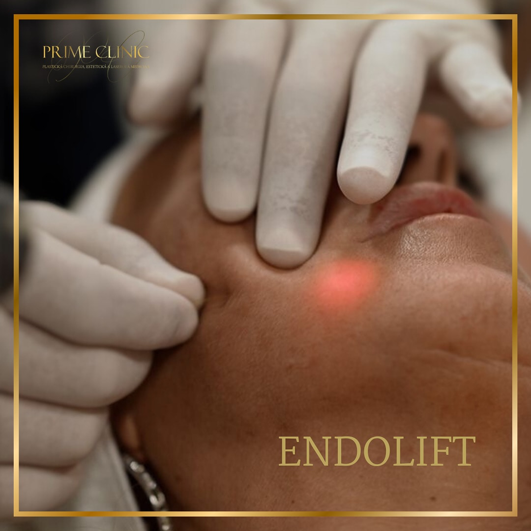 Prime Clinic treatment result