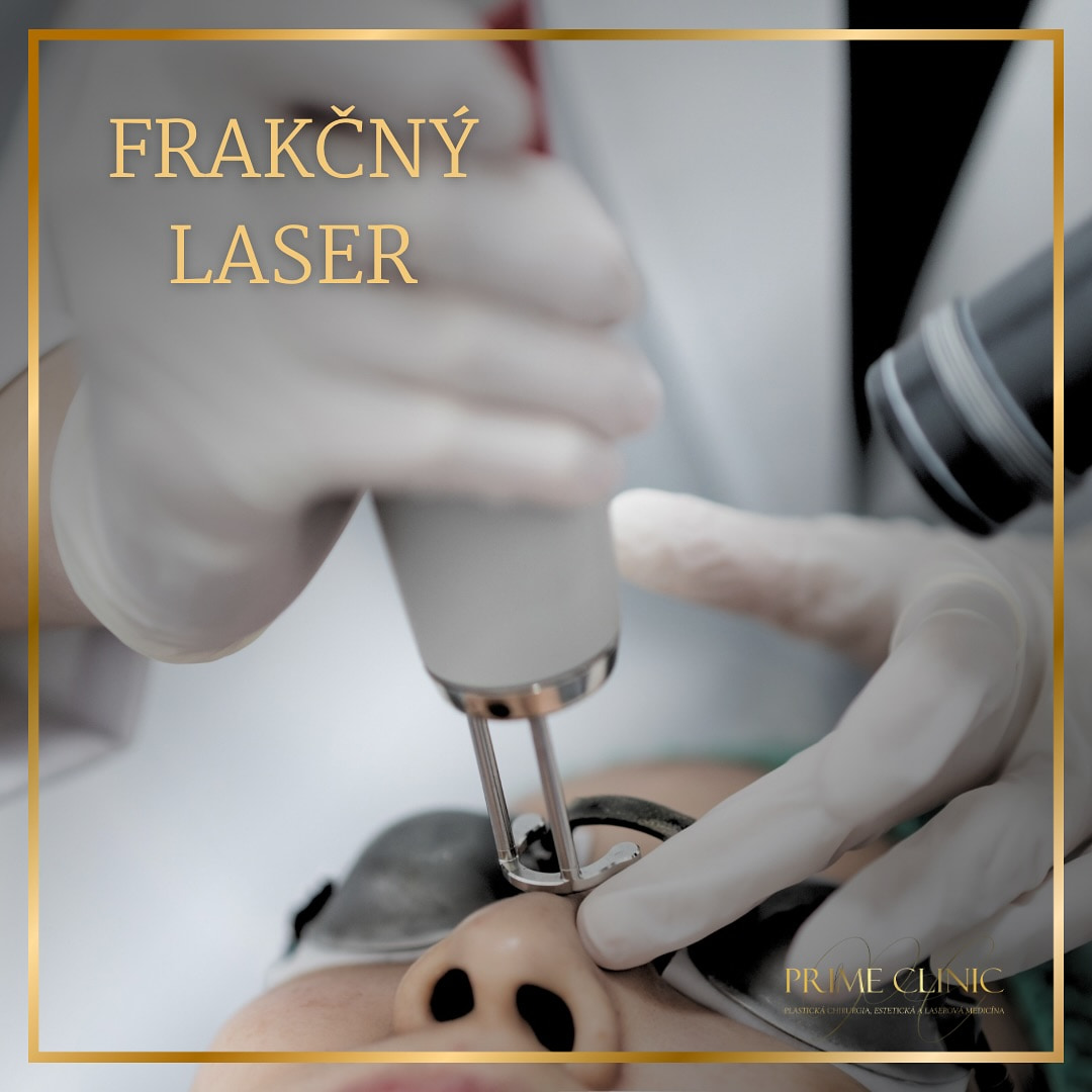 Prime Clinic treatment result