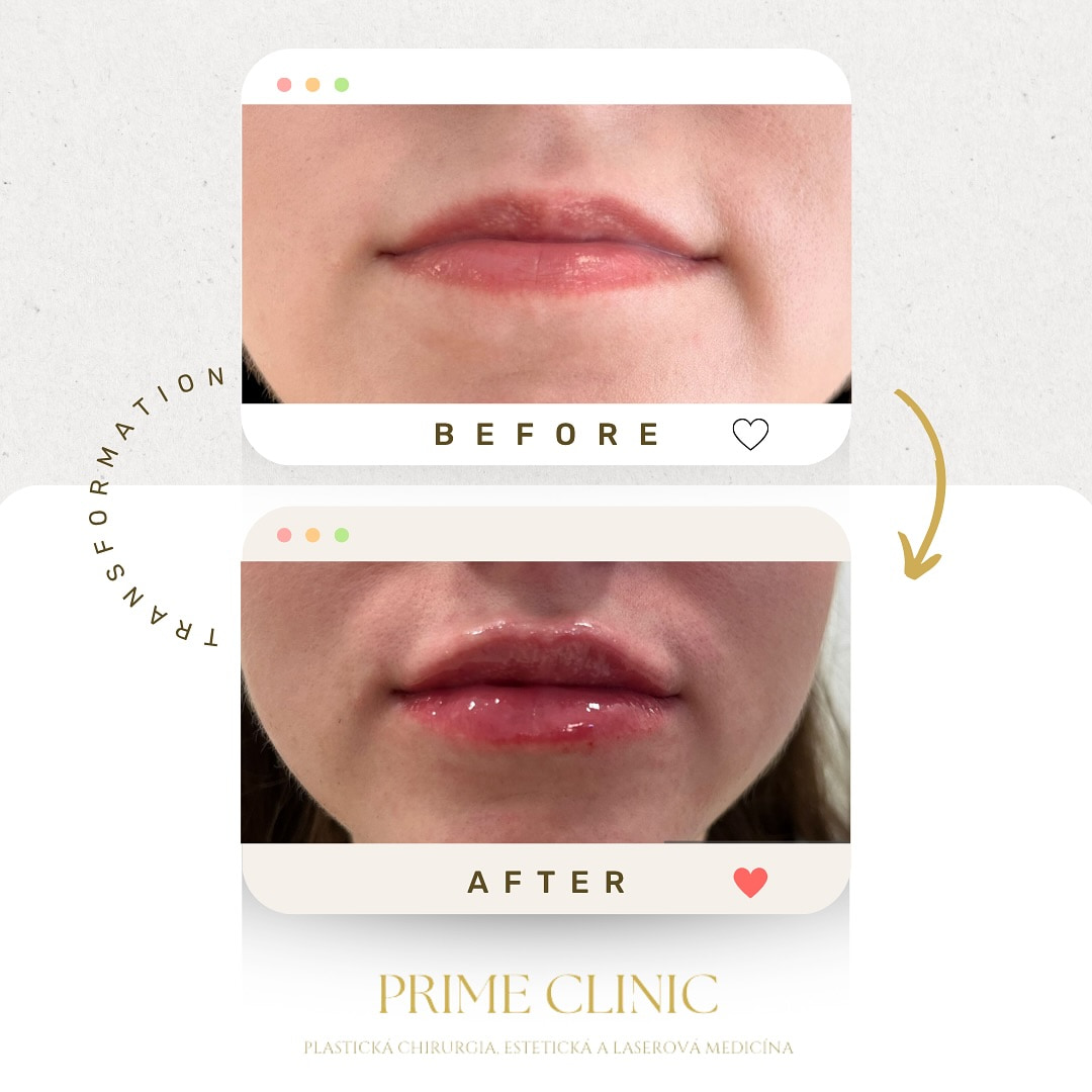 Prime Clinic treatment result