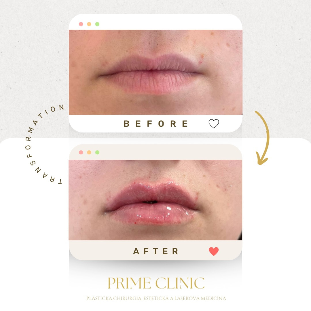 Prime Clinic treatment result