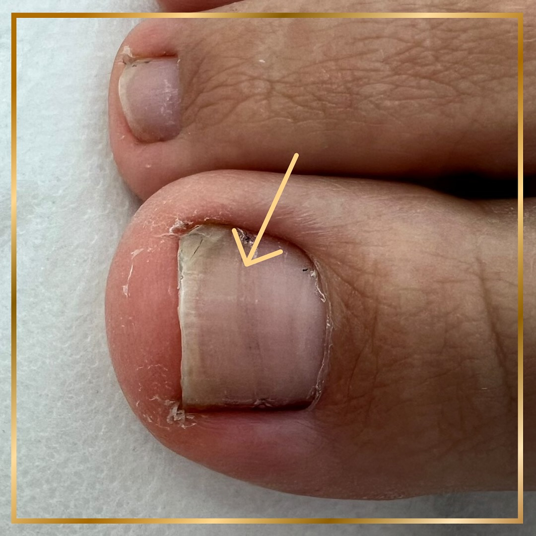Prime Clinic treatment result